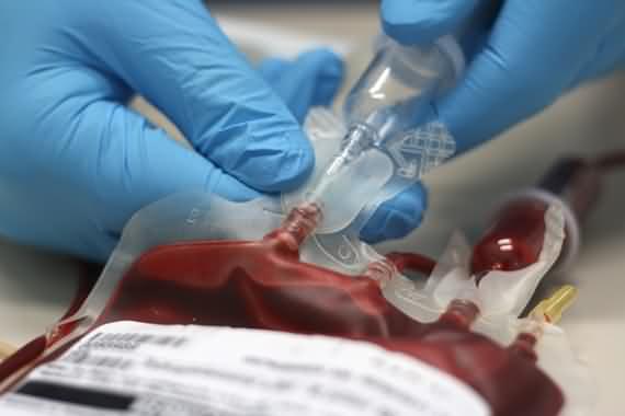 revolution of the new artificial blood, erythromer, artificial blood, blood, new artificial blood
